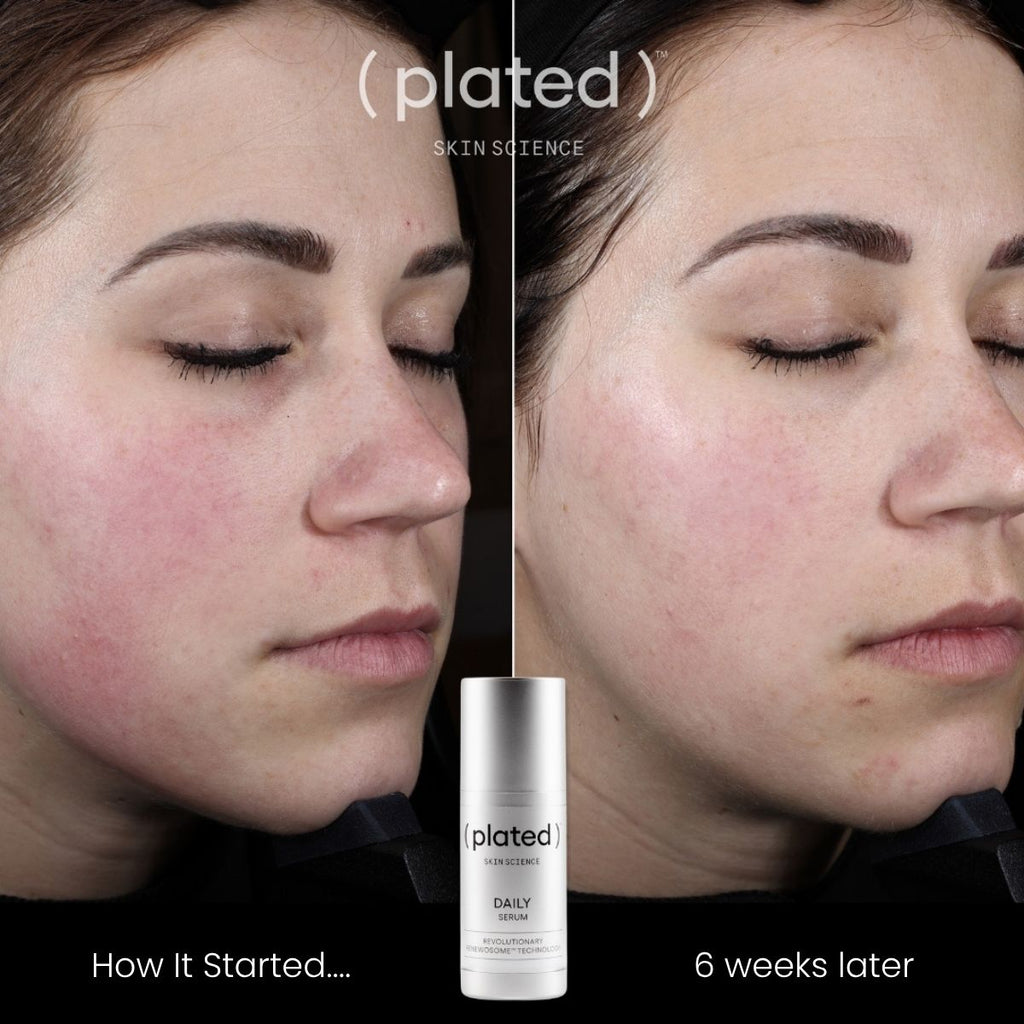 Plated Daily Serum view 2