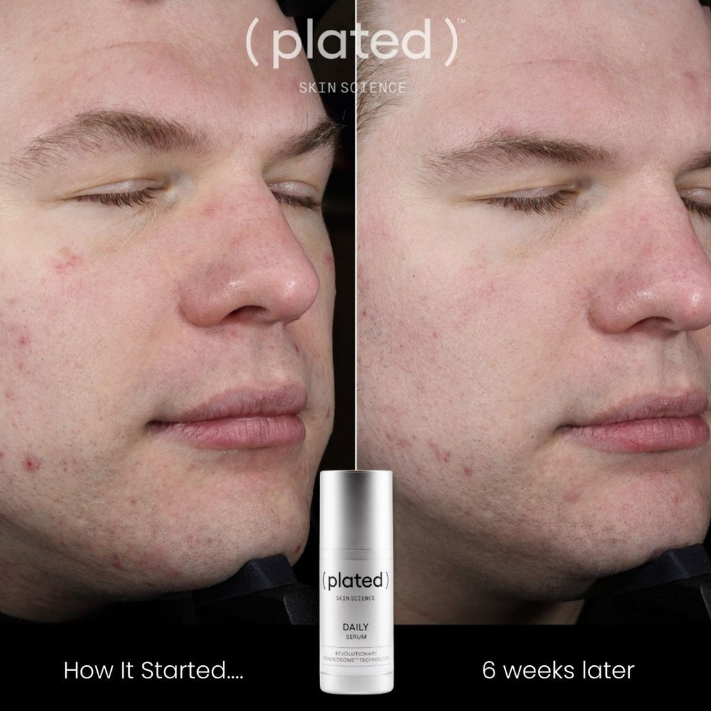 Plated Daily Serum view 3