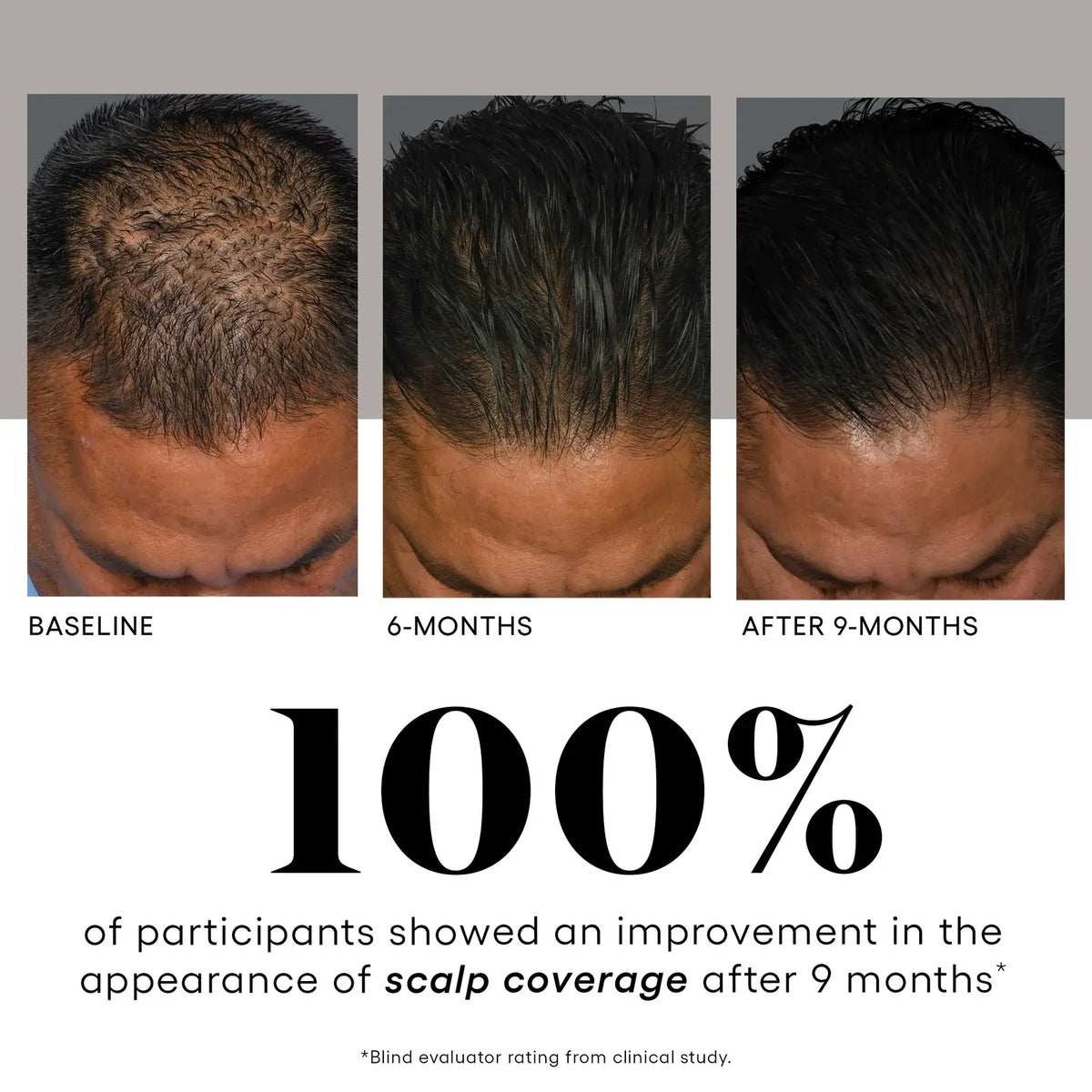 Plated HAIR Serum view 3