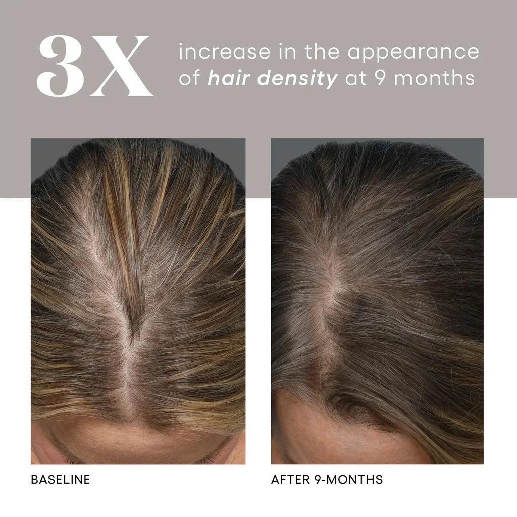 Plated HAIR Serum view 4