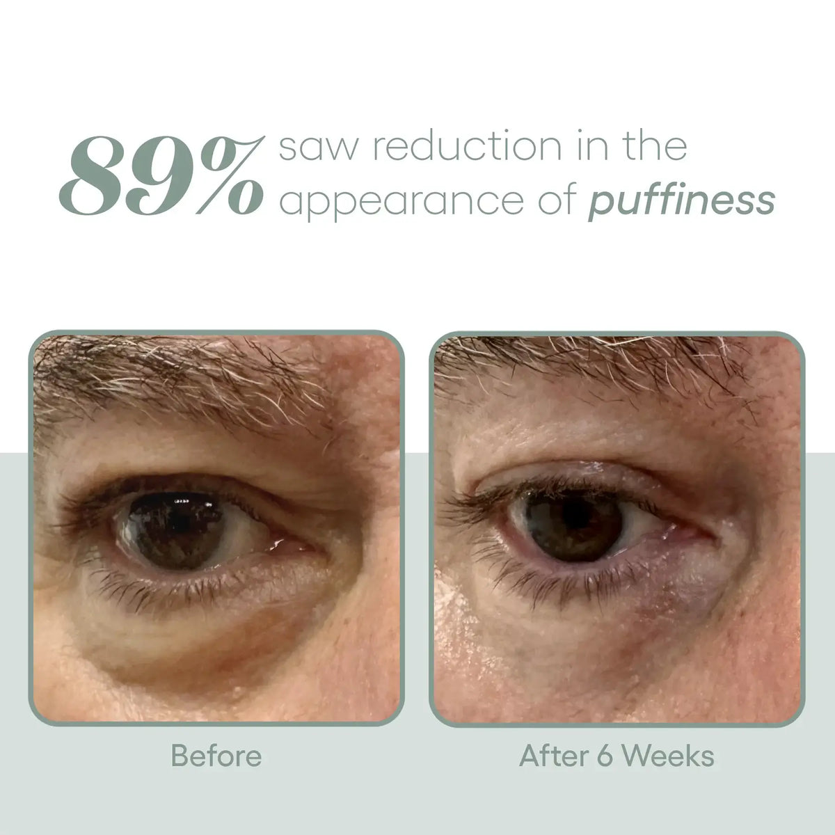 Plated EYE Serum view 3