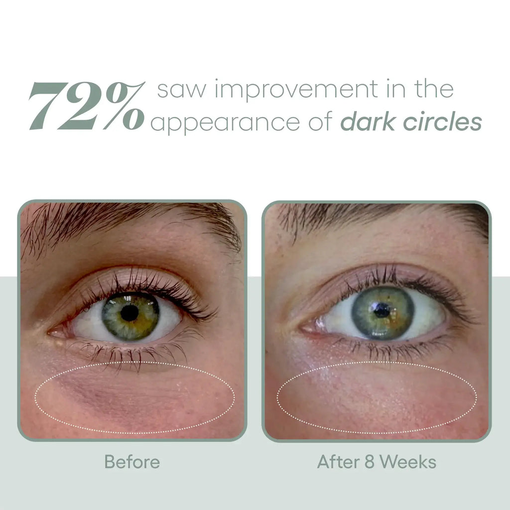 Plated EYE Serum view 4