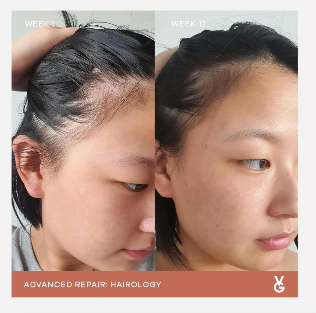 VIDA GLOW: HAIROLOGY CAPSULES ANAGAIN HAIR GROWTH SUPPLEMENT