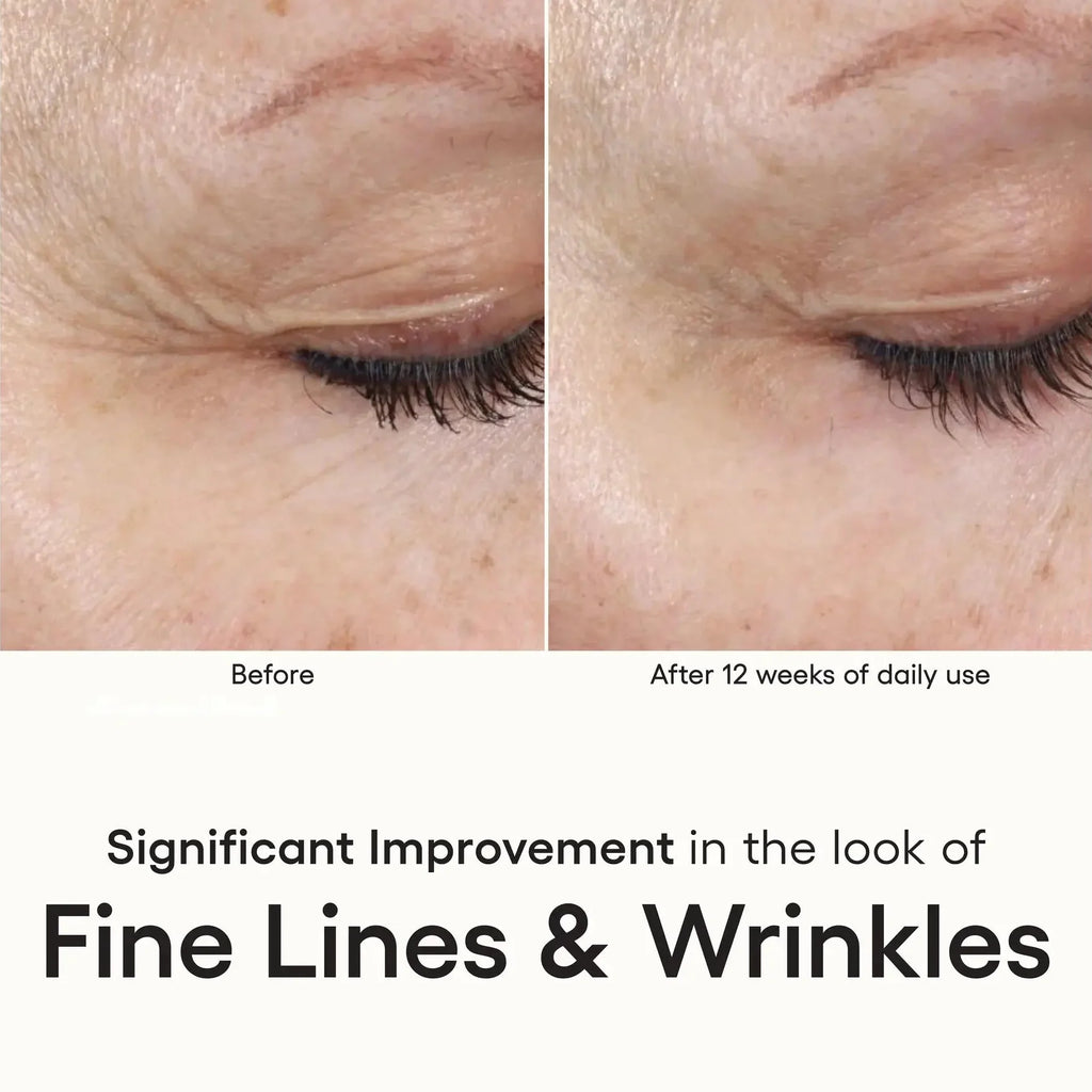 Plated Intense Serum view 3