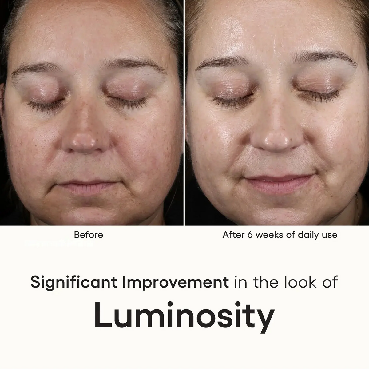 Plated Intense Serum view 4